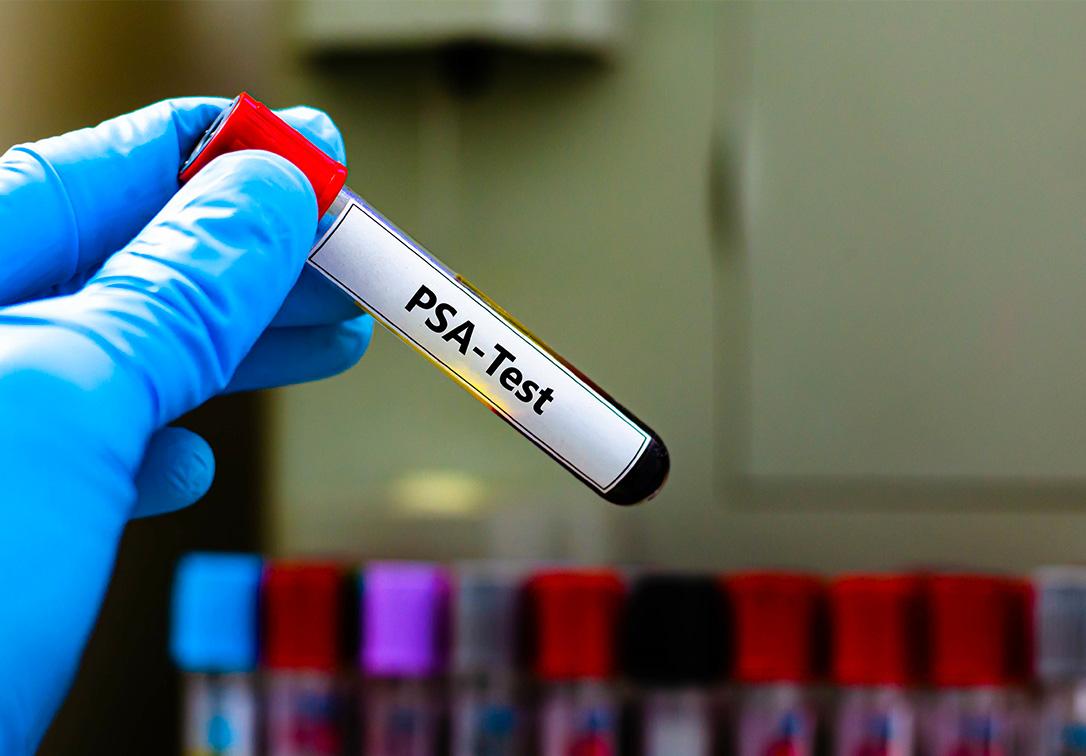 antigène spécifique de la prostate